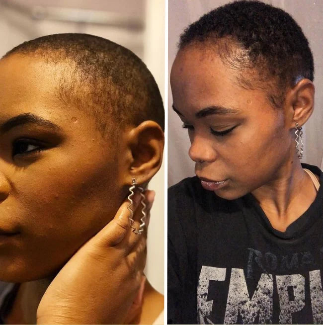 Hair growth oil