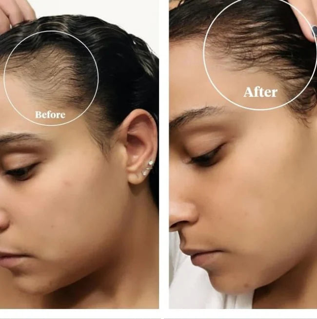 Hair growth oil